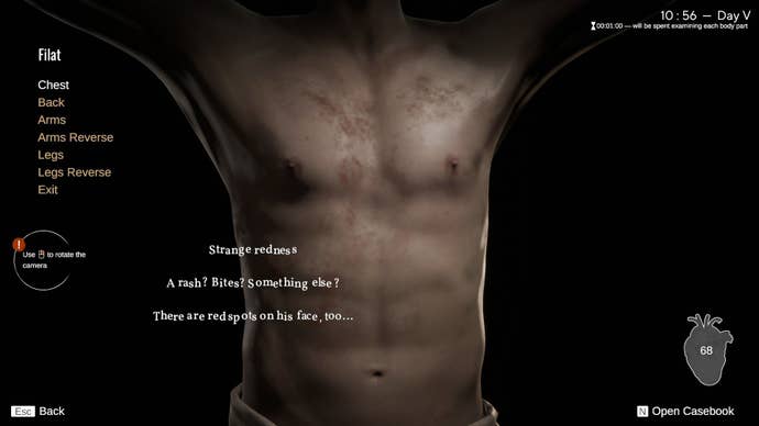 Players check the chest of a patient, encountered red signs.