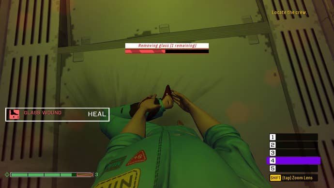 The hero of the deep skin took a piece of glass out of her leg.